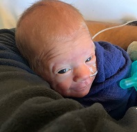 The Angelos family's younger son during his NICU stay