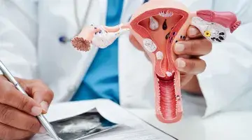 Provider holds model of female reproductive system