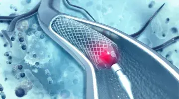 South Shore Hospital has been recognized for responsible use of heart stent procedures