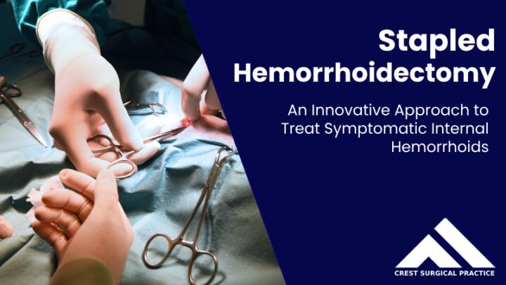 stapled haemorrhoidectomy in Singapore