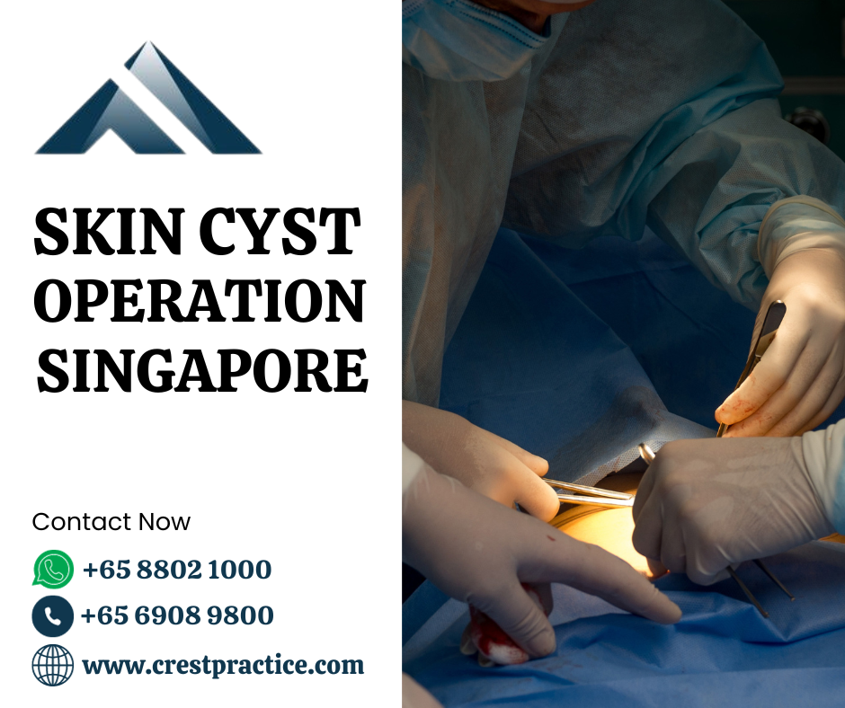 skin cyst operation in Singapore