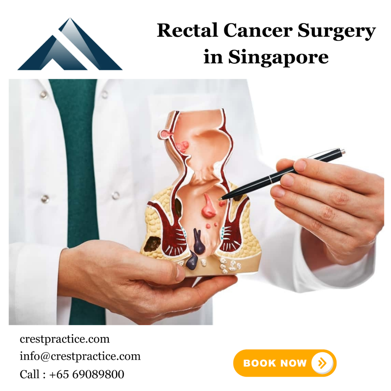 Rectal Cancer Surgery in Singapore